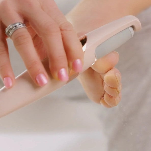 Electric Foot File and Callus Remover | Remover for Feet for Dead Skin - HairMoment™