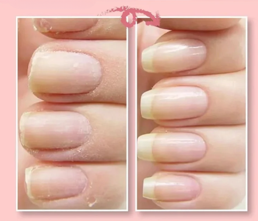 Nail repair protection gel for damaged nails - HairMoment™
